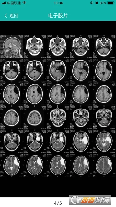 微影医生(医学影像诊断)